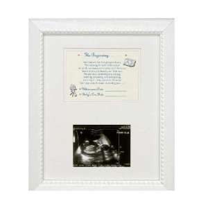  Ultrasound Picture Frame Baby