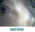 point face lift red laser therapy with 10 Collagen masks INSTANT FACE 